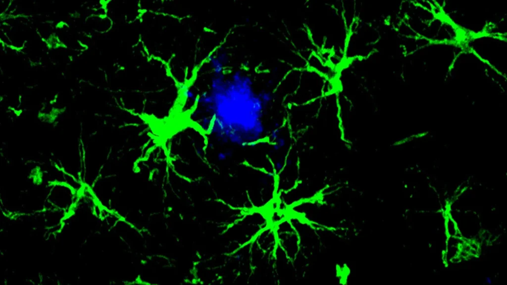 enhanced brain cells clear away dementia related proteins.webp.webp