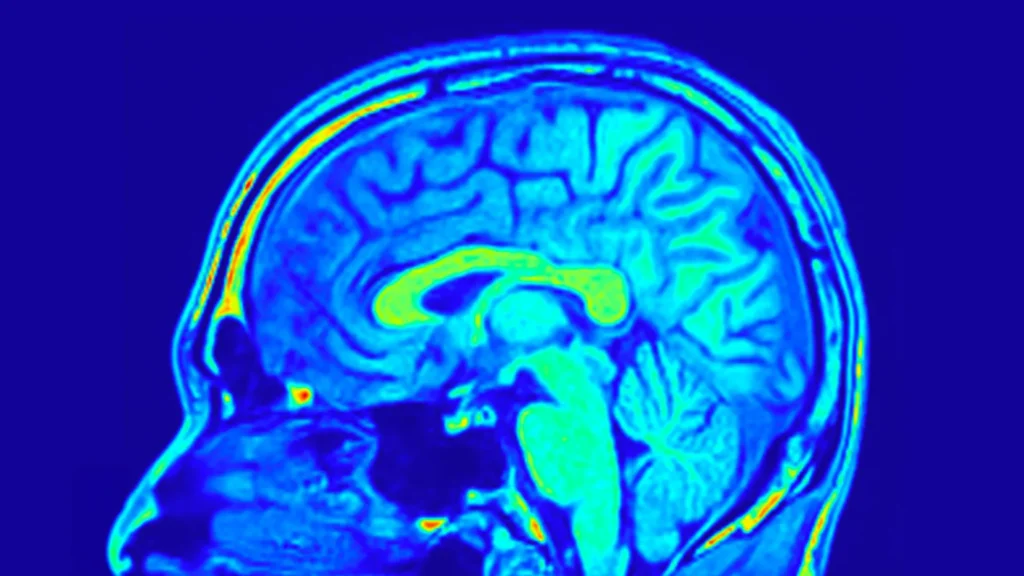 human brain mri colorful sagital slice.webp.webp