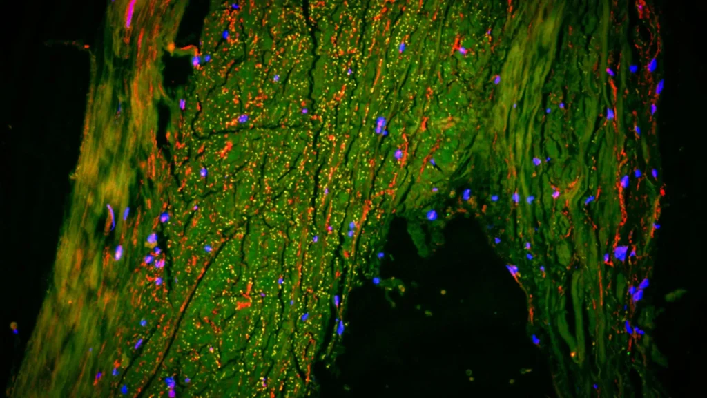 lymphatic vessels brain drainage area.webp.webp