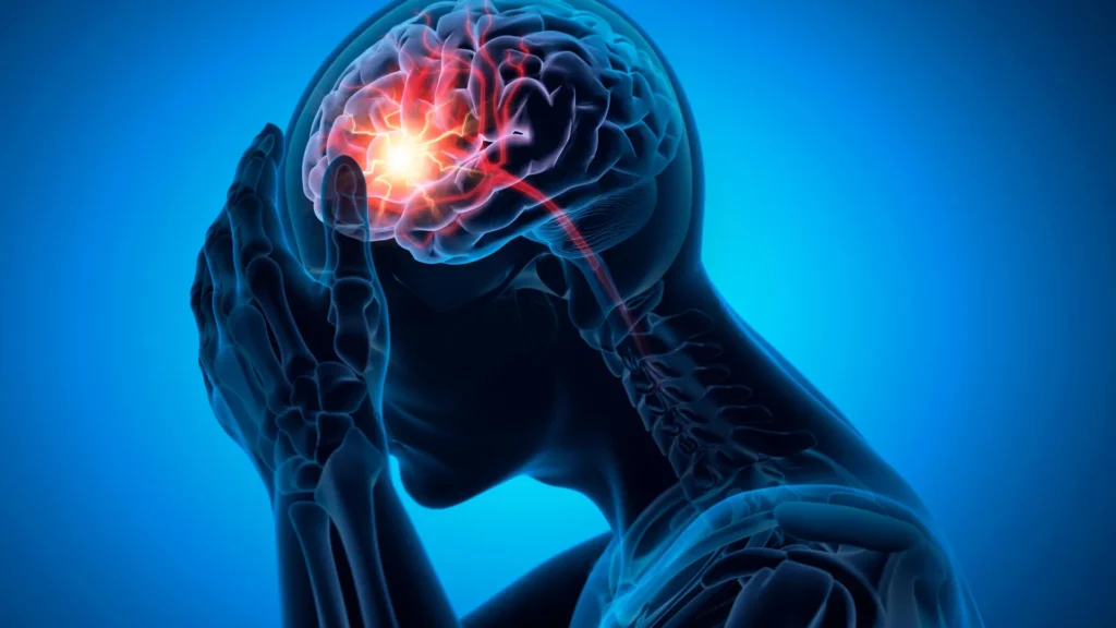 165,000 dementia sufferers divulge hidden stroke chance from commonplace drug man headache brain stroke.webp.webp