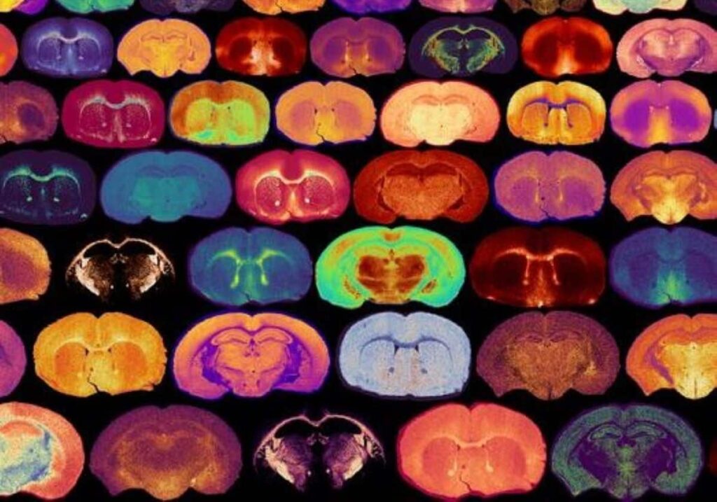 myelin glucose neuroscience.jpg