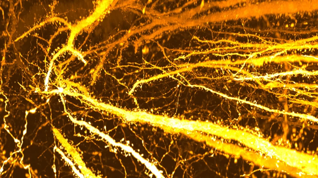 new synaptic formation in adolescent brain.webp.webp