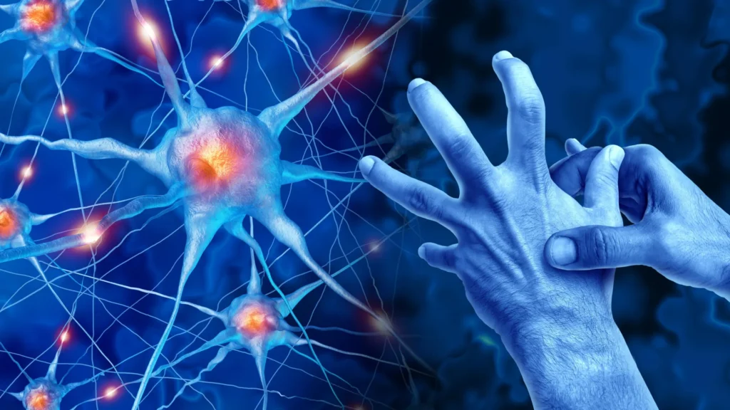 parkinsons disease neuroscience body movement disorder.webp.webp