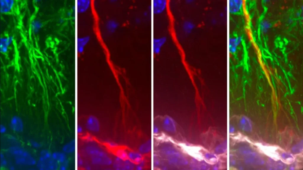 Scientists uncover hidden mind cells that can prevent Alzheimer’s tau buildup tanycytes capturing tau proteins.webp.webp