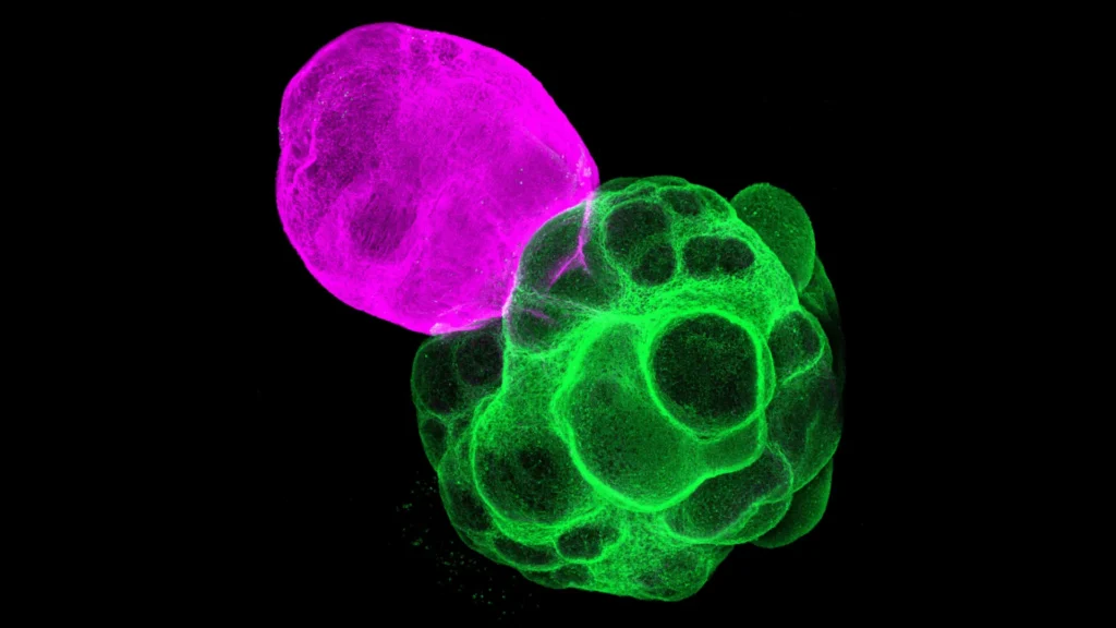 thalamus cortex assembloid.webp.webp