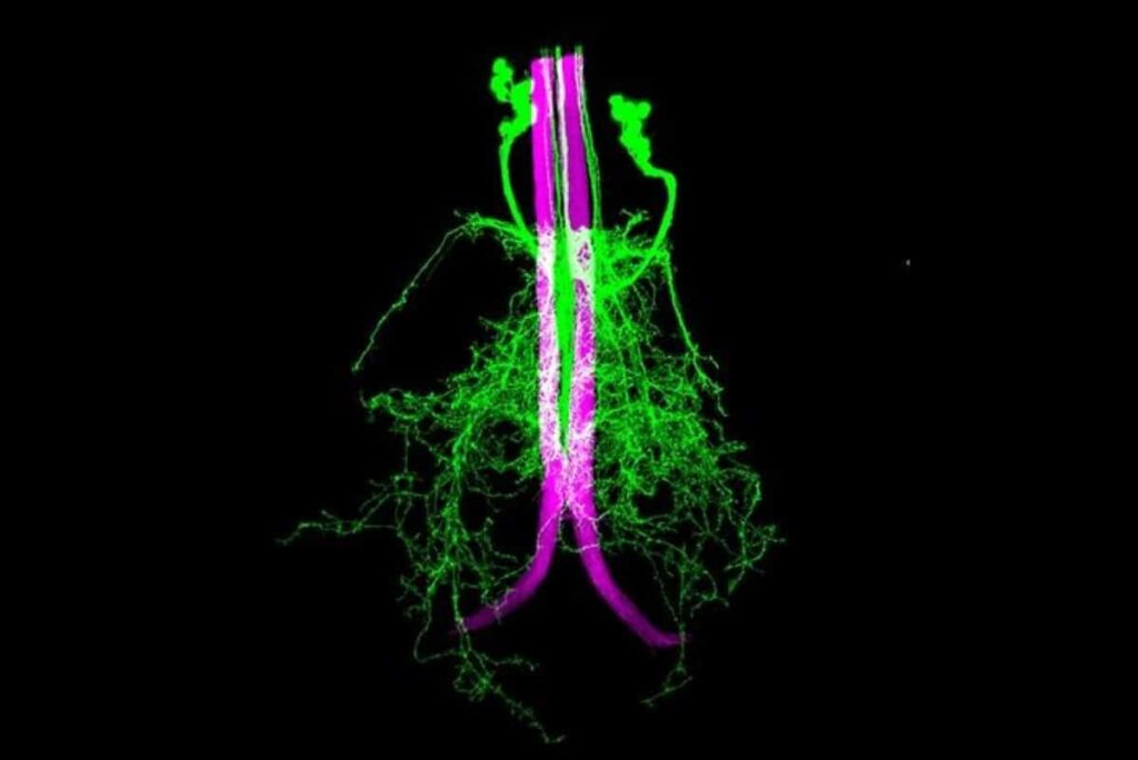 axo axonic fly brain neuroscience.jpg