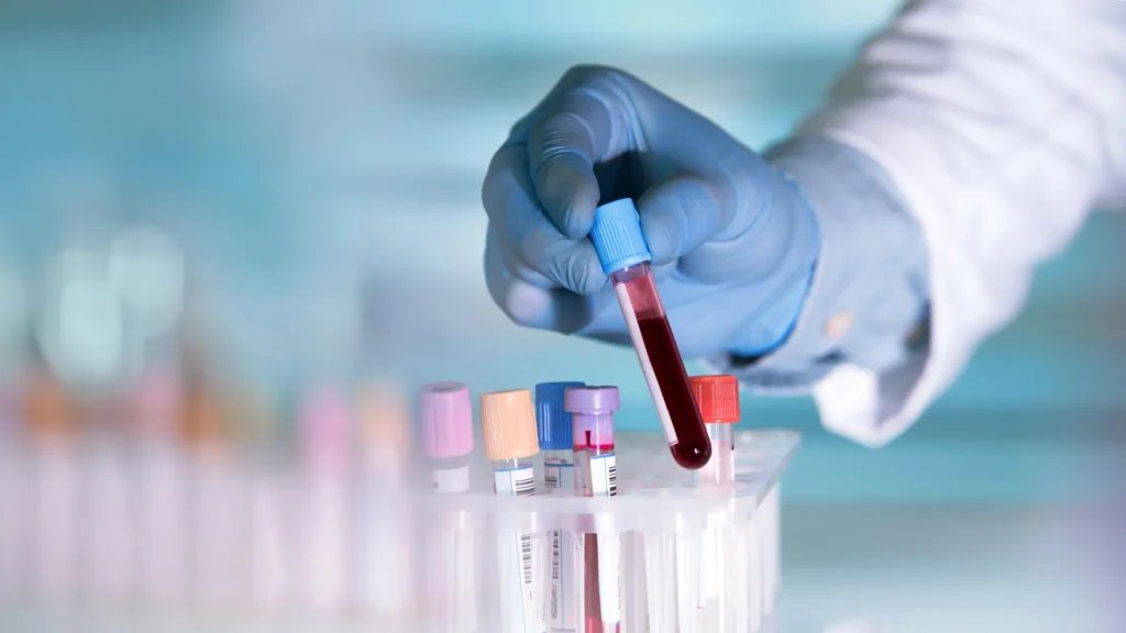 blood test tube scientist.webp.webp