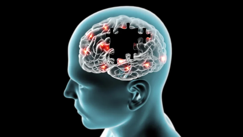 brain missing puzzle pieces degenerative diseases.webp.webp