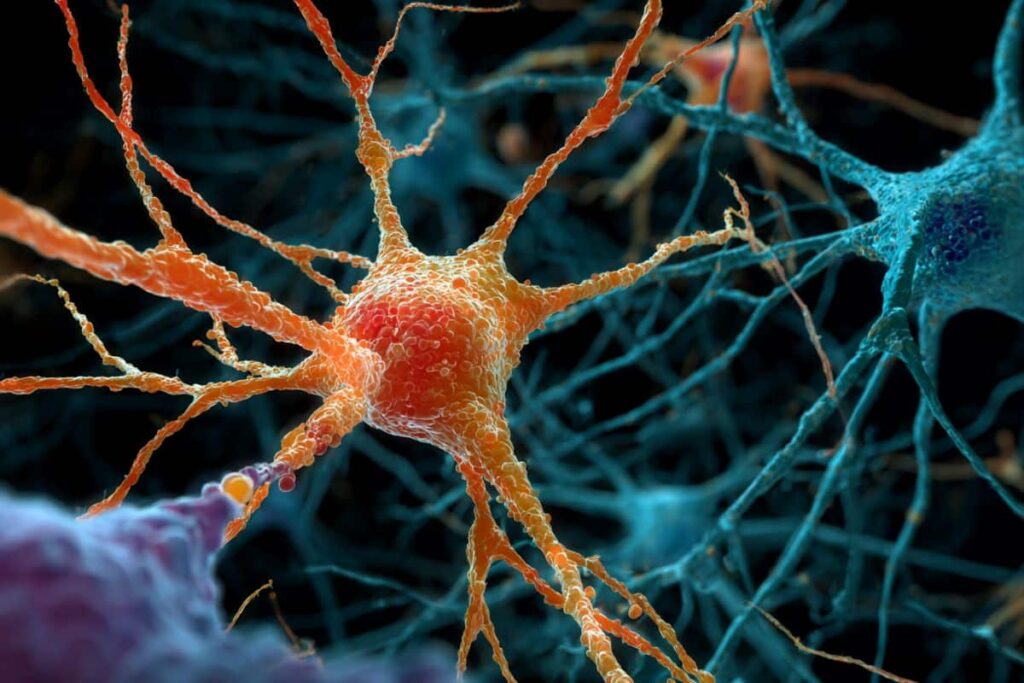 fatty microglia ms neurology.jpg