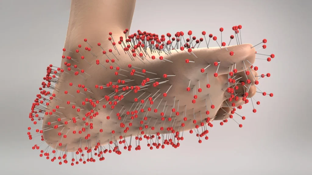 foot pins needles peripheral neuropathy pain.webp.webp