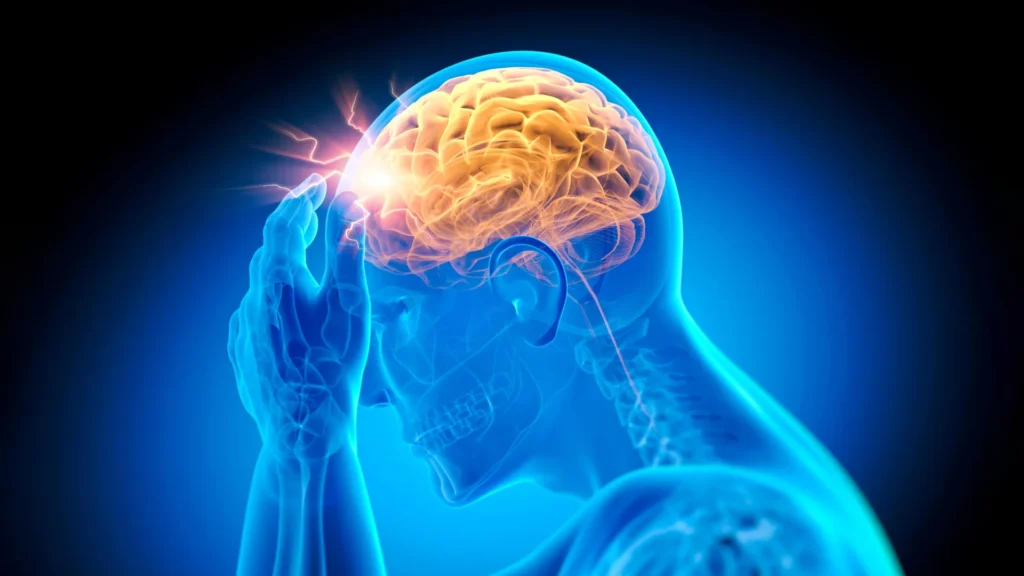 headache stroke brain pain cognitive decline.webp.webp