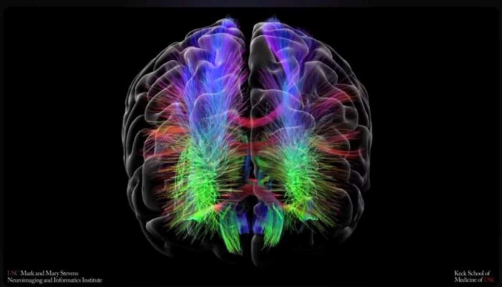 bipolar brain mapping neuroscience.jpg